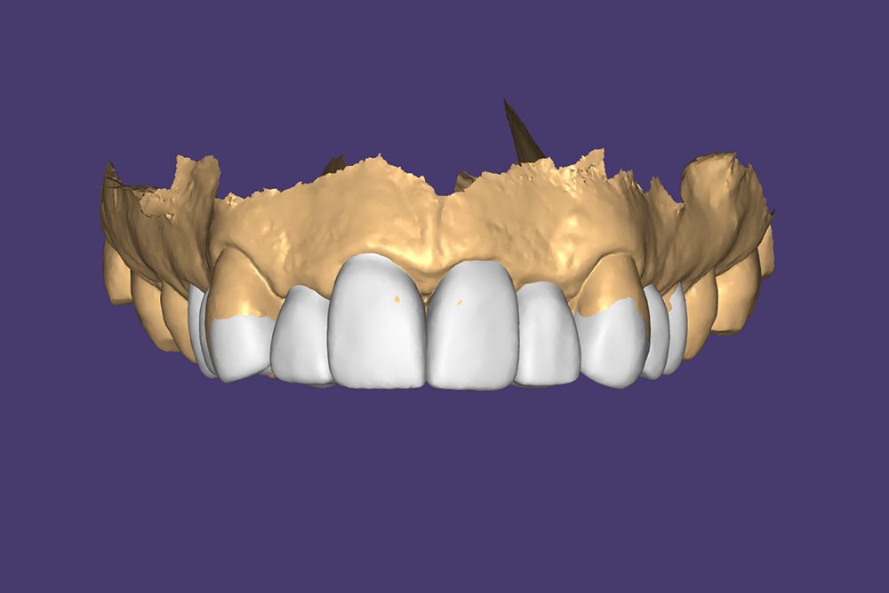 smile enhancements armagh