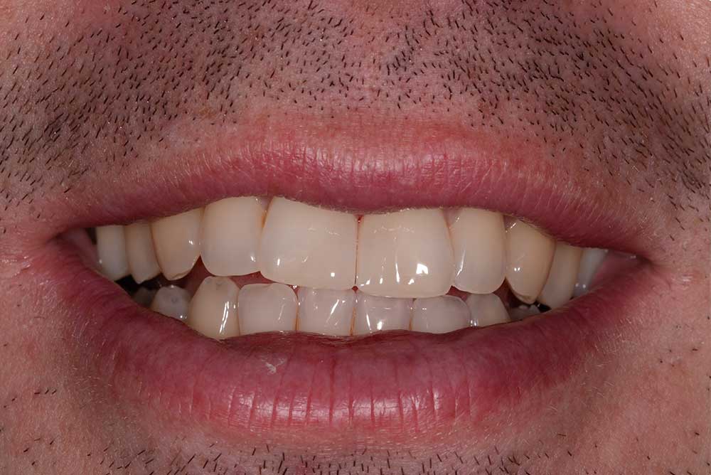 smile enhancement markethill