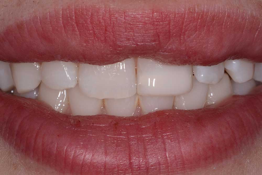 smile enhancement markethill