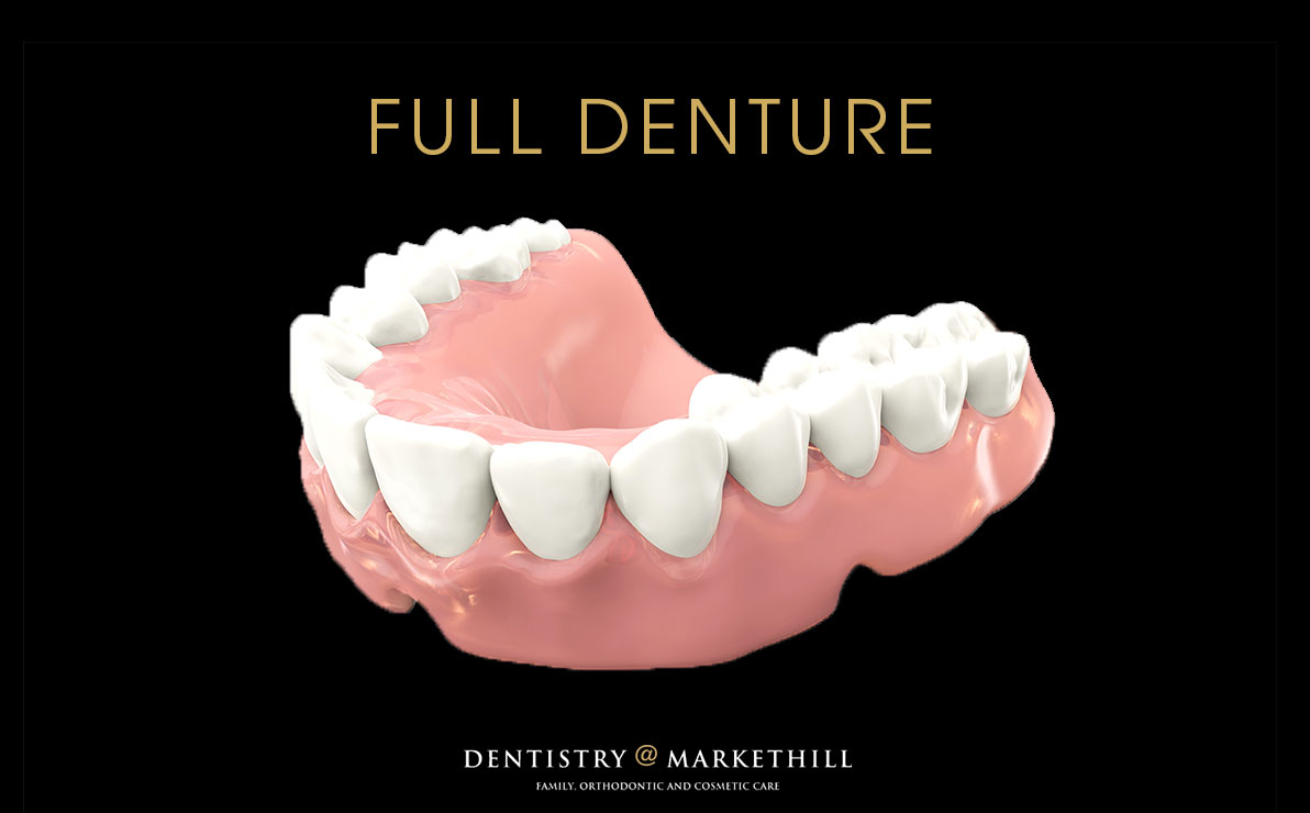 Drawing of a full arch set of lower dentures