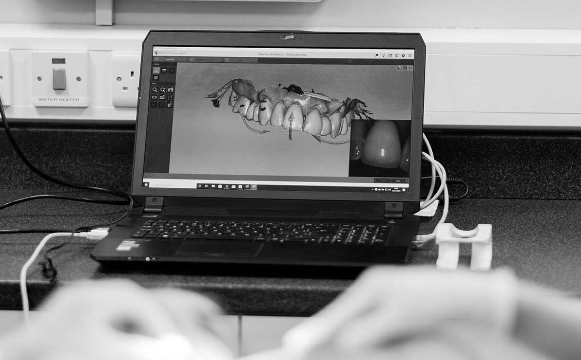 Computer screen showing real time image  of patient's tooth structure